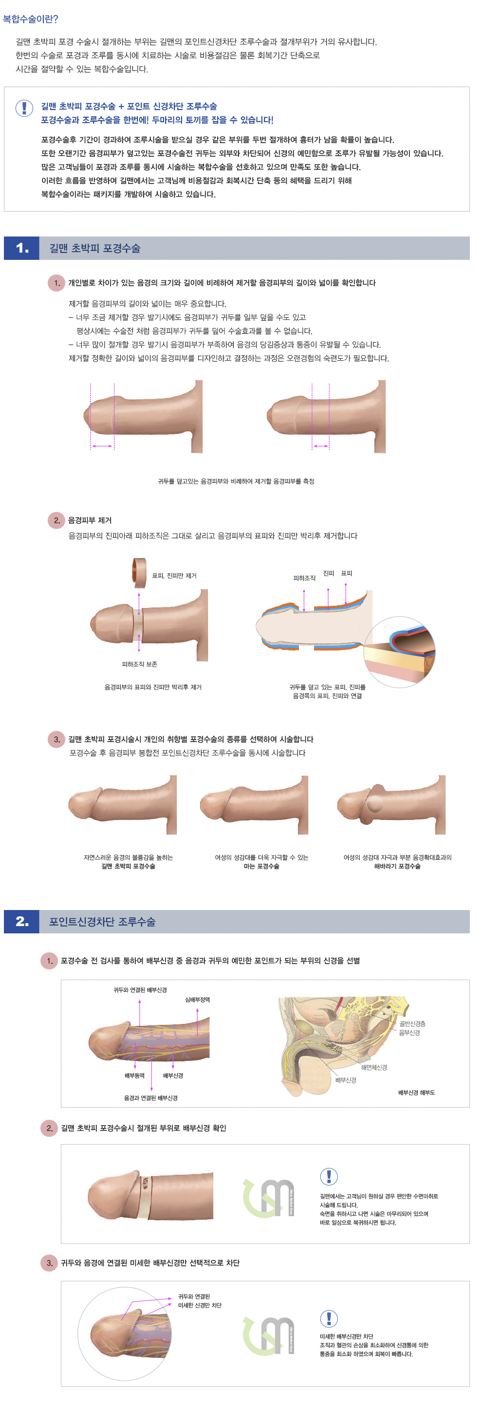 복합수술